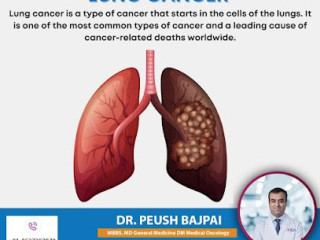 Lung Cancer Specialist in Delhi