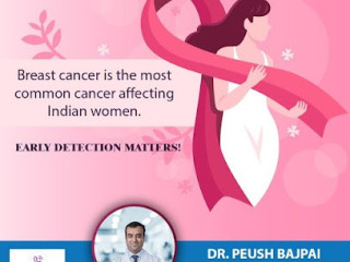 Best Breast Cancer Doctor in Delhi